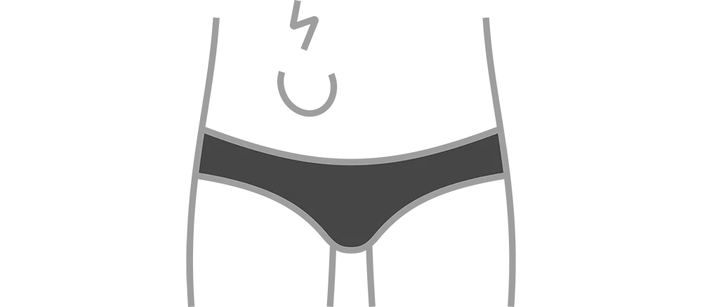 Esquema anatômico da hérnia inguinal na virilha