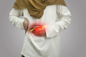 Mulher com dor intensa na região da vesícula após refeição, sinal comum de cálculo biliar.